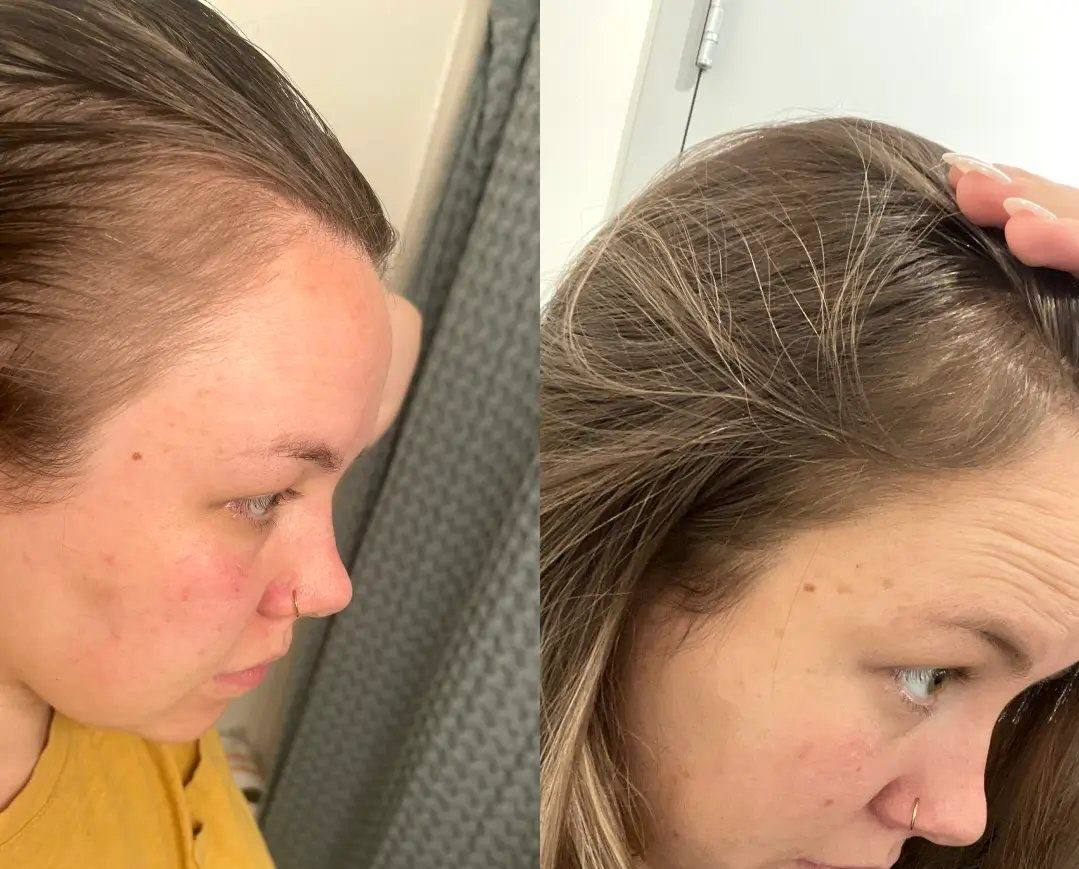 Фото результата 5